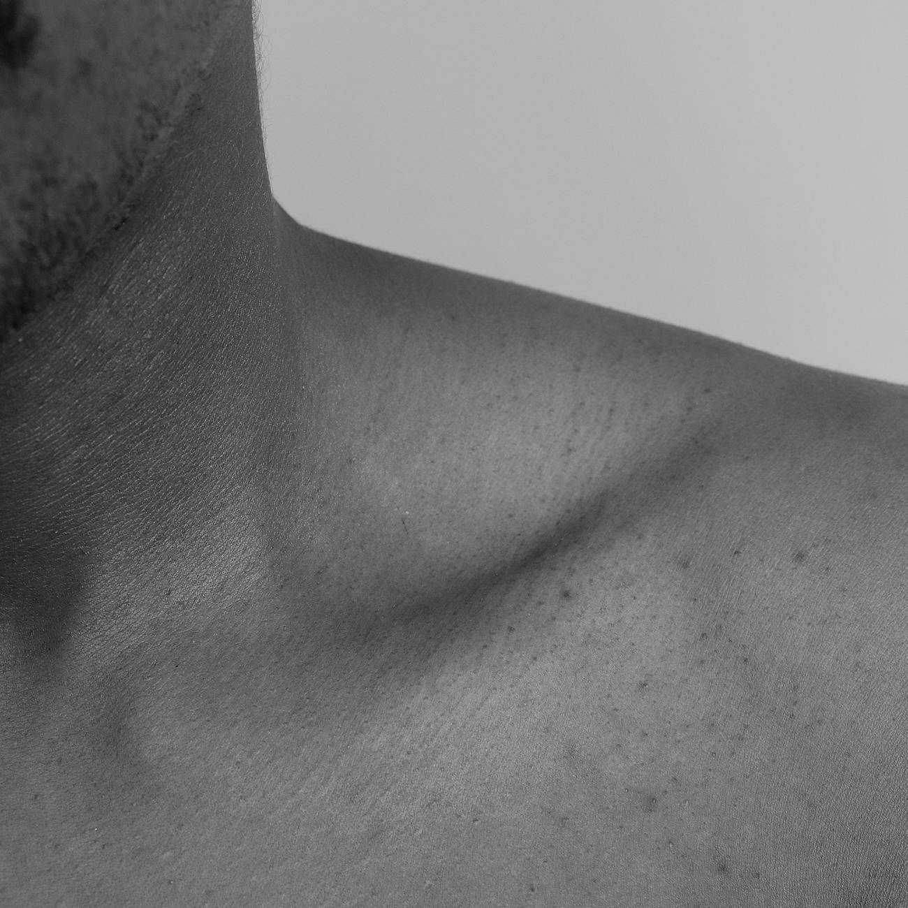 Feature Extraction and Selection for Skin Lesion Analysis