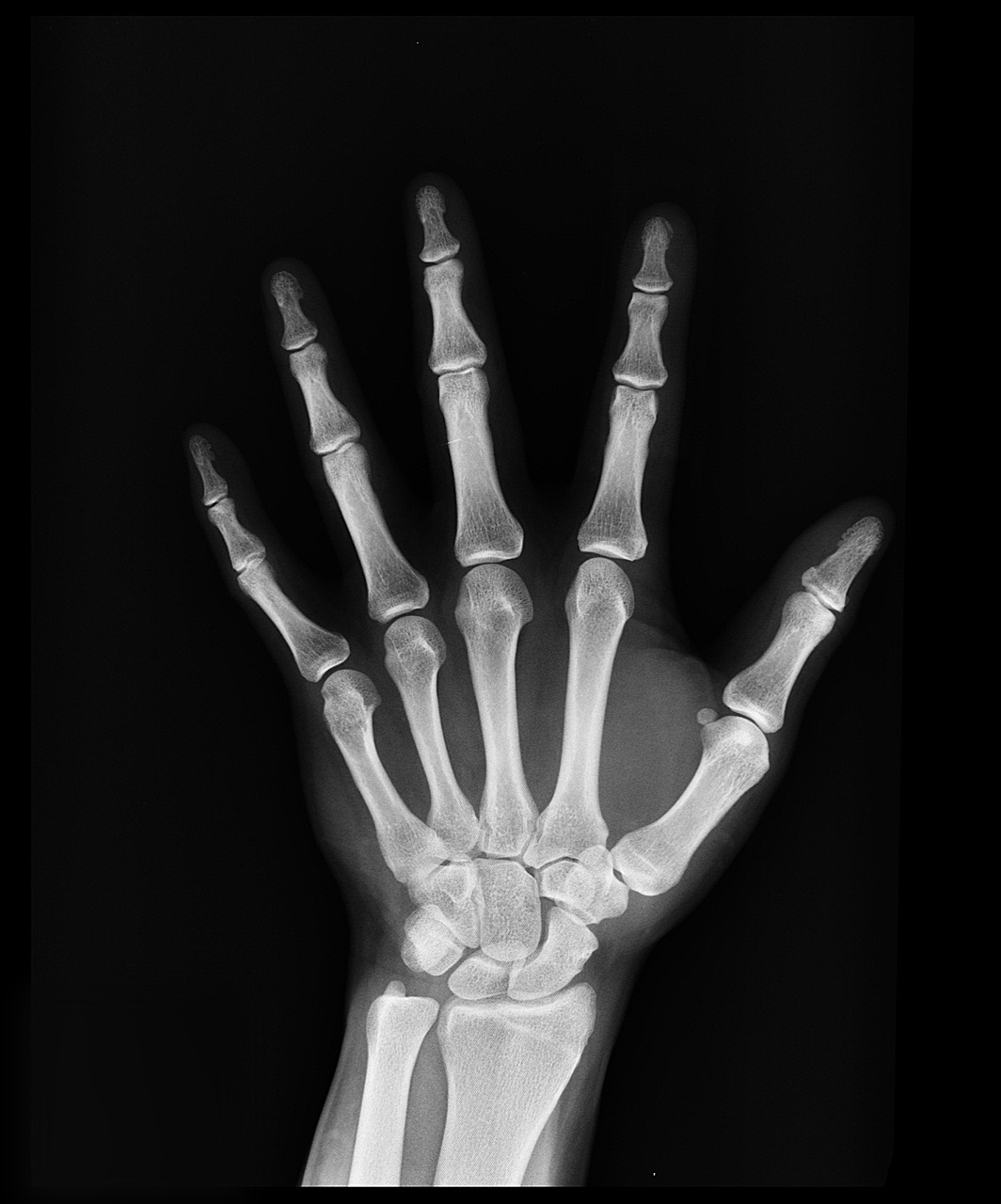 Diagnosis and Assessment of DID